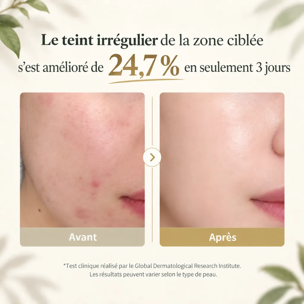Avant-après _ teint amélioré en 3 jours-1.webp